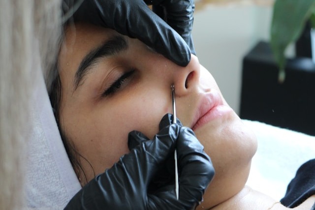 Beginner esthetics student performing extractions